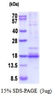 SDS-Page: Recombinant Human BDNF Protein [NBP2-52006]