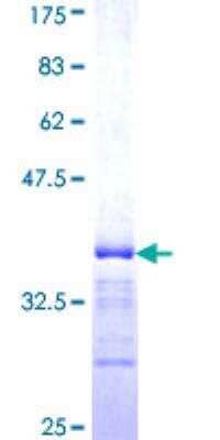 SDS-Page: Recombinant Human BICD1 Protein [H00000636-Q01] - 12.5% SDS-PAGE Stained with Coomassie Blue.