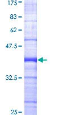 SDS-PAGE Recombinant Human BIK GST (N-Term) Protein