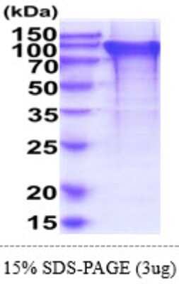 SDS-Page: Recombinant Human BIN2 Isoform 1 Protein [NBP2-61975] - 15% SDS-PAGE (3ug)