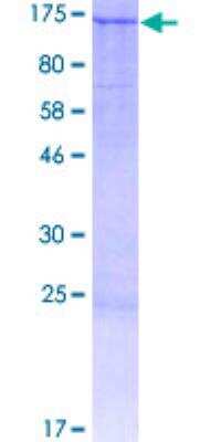 SDS-Page: Recombinant Human BNC1 Protein [H00000646-P01] - 12.5% SDS-PAGE Stained with Coomassie Blue.