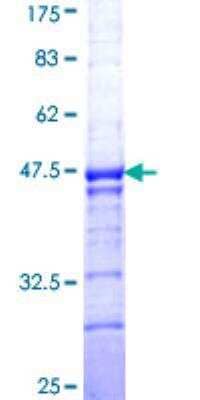 SDS-Page: Recombinant Human BNC1 Protein [H00000646-Q01] - 12.5% SDS-PAGE Stained with Coomassie Blue.