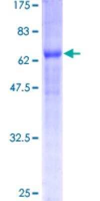 SDS-PAGE Recombinant Human BNIP2 GST (N-Term) Protein