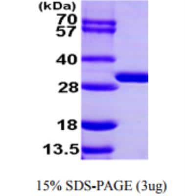 Recombinant Human BPHL Protein [NBP1-50954]