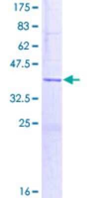 SDS-Page: Recombinant Human BRP44 Protein [H00025874-P02] - 12.5% SDS-PAGE Stained with Coomassie Blue.