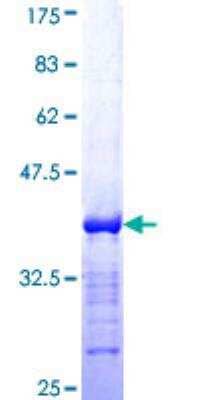 SDS-PAGE Recombinant Human Bcl-9 GST (N-Term) Protein