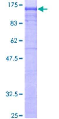 SDS-Page: Recombinant Human Beta 2 Adaptin Protein [H00000163-P01] - 12.5% SDS-PAGE Stained with Coomassie Blue.