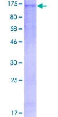 SDS-Page: Recombinant Human Bub1 Protein [H00000699-P01] - 12.5% SDS-PAGE Stained with Coomassie Blue.