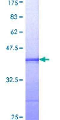 SDS-Page: Recombinant Human Bub1 Protein [H00000699-Q01] - 12.5% SDS-PAGE Stained with Coomassie Blue.