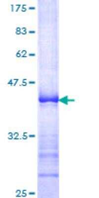 SDS-Page: Recombinant Human BubR1 Protein [H00000701-Q01] - 12.5% SDS-PAGE Stained with Coomassie Blue.