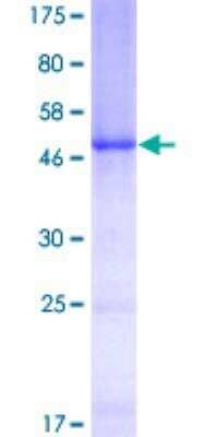 SDS-PAGE Recombinant Human C1QB GST (N-Term) Protein