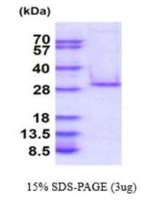 SDS-PAGE Recombinant Human C1qTNF5/CTRP5 His Protein