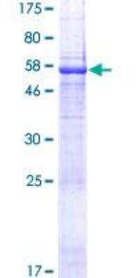 SDS-PAGE Recombinant Human C5orf36 GST (N-Term) Protein
