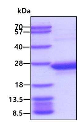 SDS-Page: Recombinant Human C8G Protein [NBP1-72476] - 3ug by SDS-PAGE under reducing condition and visualized by coomassie blue stain