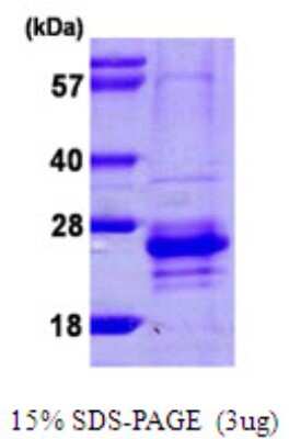 SDS-Page: Recombinant Human CABP7 Protein [NBP1-51094] - 15 % SDS-PAGE (3ug)