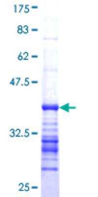SDS-Page: Recombinant Human CACNA1E Protein [H00000777-Q01] - 12.5% SDS-PAGE Stained with Coomassie Blue.