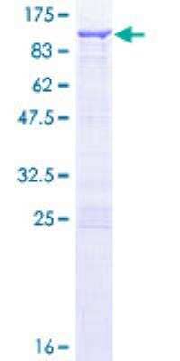 SDS-Page: Recombinant Human CACNB1 Protein [H00000782-P01] - 12.5% SDS-PAGE Stained with Coomassie Blue.