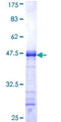 SDS-Page: Recombinant Human CACNB1 Protein [H00000782-Q01] - 12.5% SDS-PAGE Stained with Coomassie Blue.