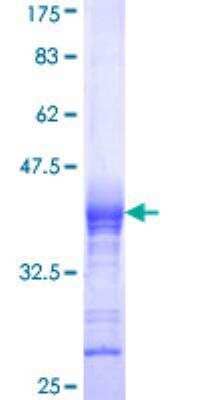 SDS-PAGE Recombinant Human CACNB2 GST (N-Term) Protein