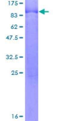 SDS-PAGE Recombinant Human CACNB4 GST (N-Term) Protein