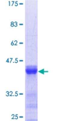 SDS-Page: Recombinant Human CACNB4 Protein [H00000785-Q01] - 12.5% SDS-PAGE Stained with Coomassie Blue.