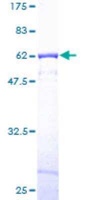 SDS-Page: Recombinant Human CAPZA1 Protein [H00000829-P01] - 12.5% SDS-PAGE Stained with Coomassie Blue.