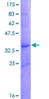 SDS-Page: Recombinant Human CAPZB Protein [H00000832-P01] - 12.5% SDS-PAGE Stained with Coomassie Blue.