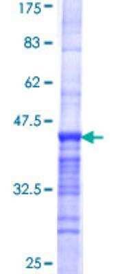 Recombinant Human CASC5 Protein [H00057082-Q01] - 12.5% SDS-PAGE Stained with Coomassie Blue.