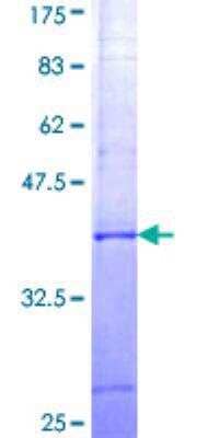 SDS-Page: Recombinant Human CBFA2T3 Protein [H00000863-Q01] - 12.5% SDS-PAGE Stained with Coomassie Blue.