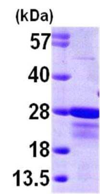 SDS-Page: Recombinant Human CBFB Protein [NBP1-45317] - 15% SDS-PAGE (3ug)