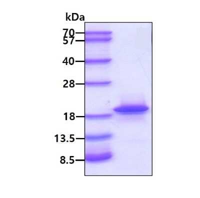 SDS-PAGE Recombinant Human CBP20 His Protein