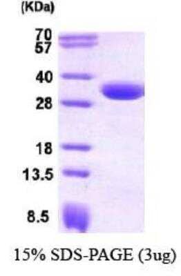 SDS-Page: Recombinant Human CBR1 Protein [NBC1-26370] -  CBR1, 30 kDa (277aa), confirmed by MALDI-TOF with a purity of 95% by SDS - PAGE