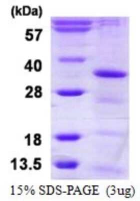 SDS-PAGE Recombinant Human CCDC5 His Protein