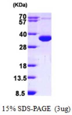 SDS-PAGE Recombinant Human CCS/SOD4 His Protein