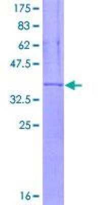 SDS-PAGE Recombinant Human CD11c GST (N-Term) Protein