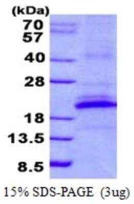 SDS-Page: Recombinant Human CD161 Protein [NBP2-23169]