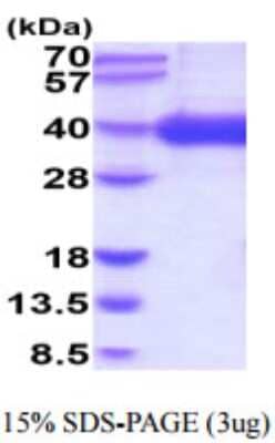 SDS-PAGE Recombinant Human CD1a His Protein