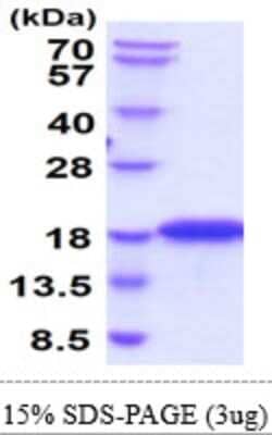 SDS-PAGE Recombinant Mouse CD1d His Protein