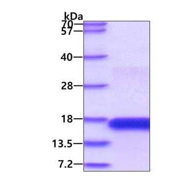 SDS-PAGE Recombinant Human CD3 epsilon His Protein