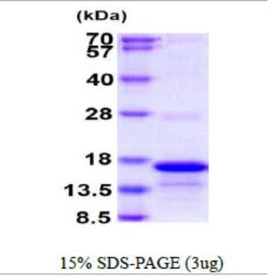 SDS-Page: Recombinant Human CD3 zeta Protein [NBP2-22747] - 15% SDS-PAGE (3ug)