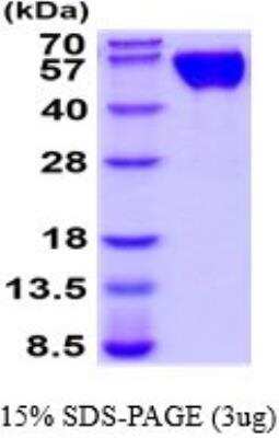 SDS-Page: Recombinant Human CD47 Protein [NBP2-52320] - 15% SDS Page (3 ug)