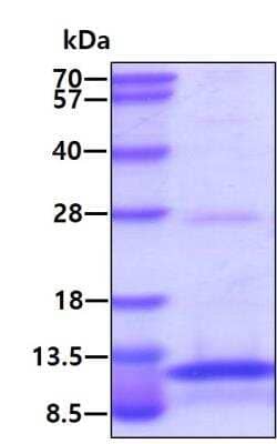 SDS-Page: Recombinant Human CD9 Protein [NBP2-51977] - 3ug by SDS-PAGE under reducing condition and visualized by coomassie blue stain