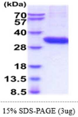 SDS-Page: Recombinant Human TPSAB1 Protein [NBP2-61189] - 15 % SDS-PAGE (3ug)