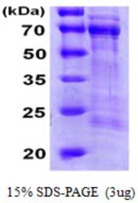 SDS-Page: Recombinant Human CDC25A Protein [NBP1-51019] - 15 % SDS-PAGE (3ug)