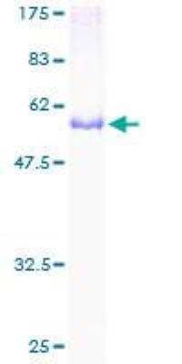 SDS-PAGE Recombinant Human CDK20 GST (N-Term) Protein