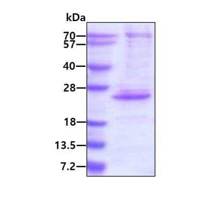SDS-PAGE Recombinant Human CENPM His Protein