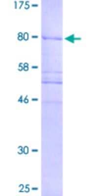 SDS-PAGE Recombinant Human CEP57 GST (N-Term) Protein