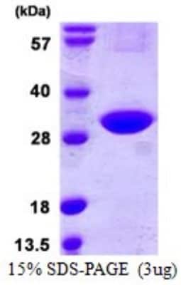 SDS-Page: Recombinant Human CINP Protein [NBP1-72364] - 15% SDS-PAGE (3ug)