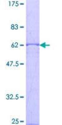 SDS-Page: Recombinant Human CISH/CIS-1 Protein [H00001154-P02] - 12.5% SDS-PAGE Stained with Coomassie Blue.