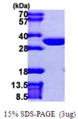 SDS-PAGE Recombinant Human CLIC2 His Protein